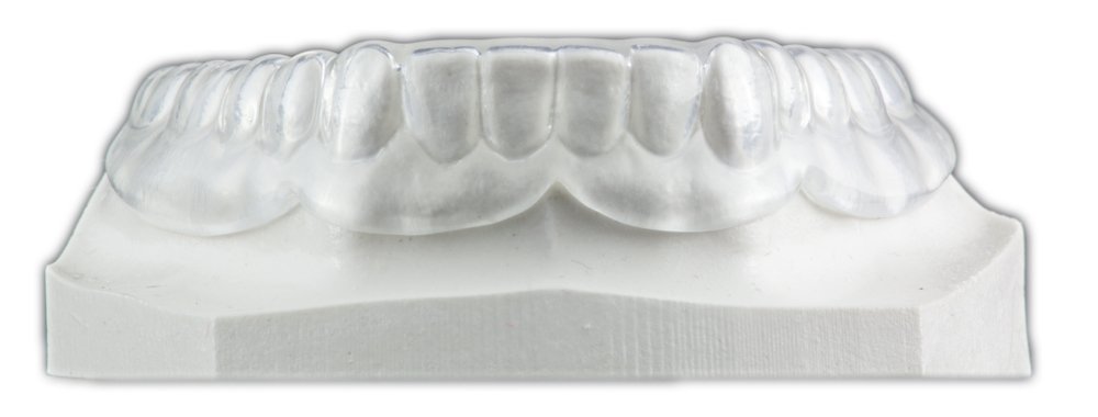 Soft Occlusal Splint