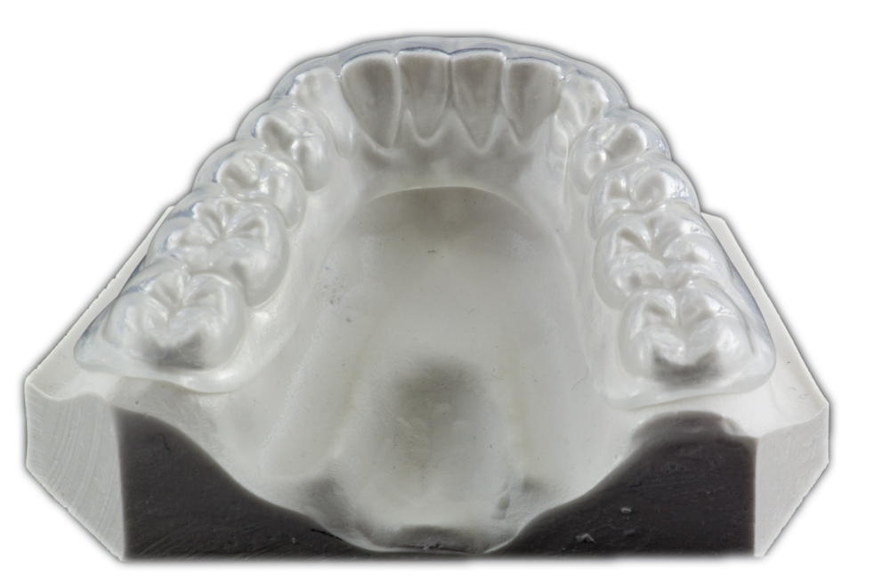 Soft Occlusal Splint