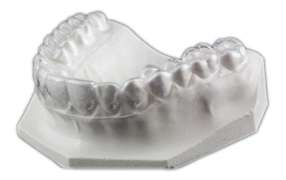 Hard Occlusal Splint