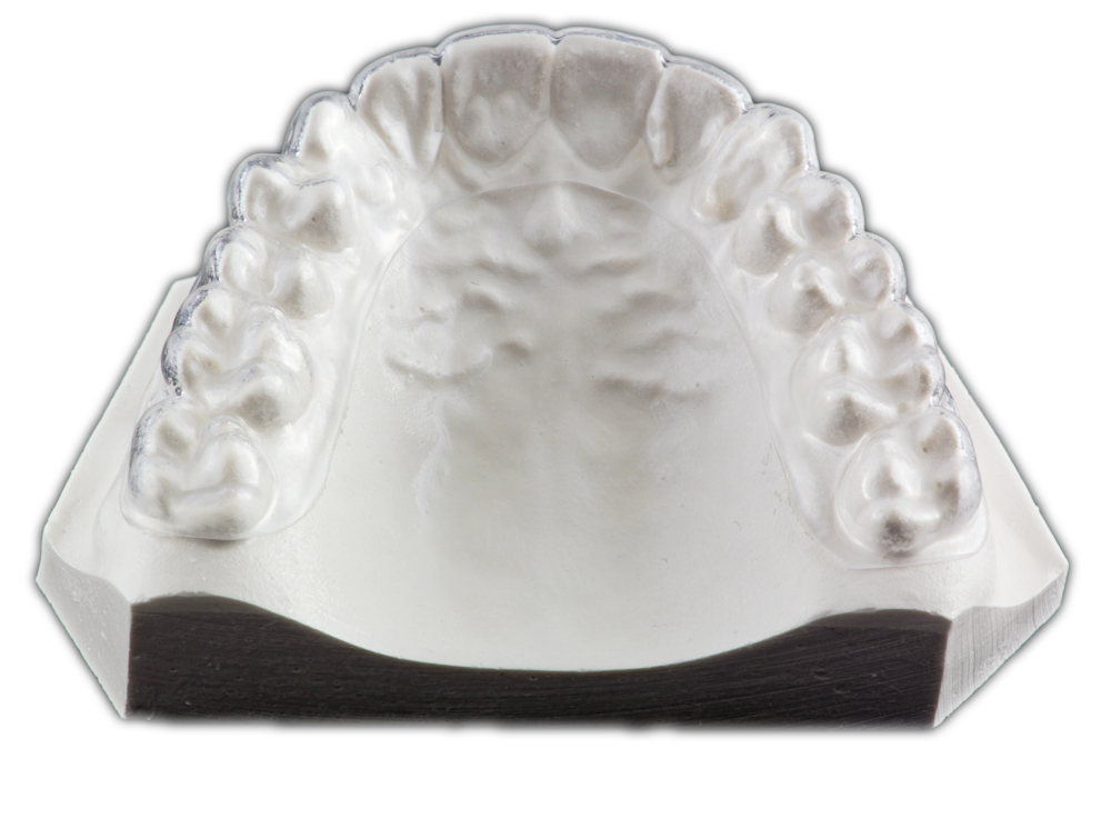 Hard Occlusal Splint