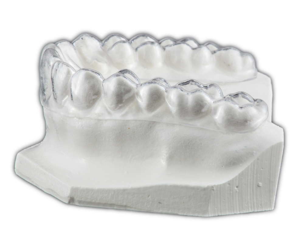 Hard Occlusal Splint