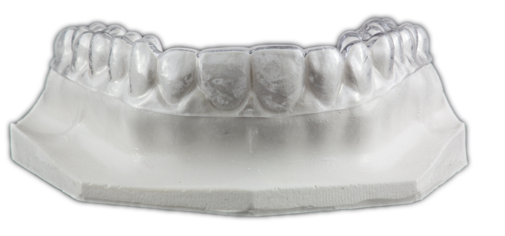 Hard Orthodontic Retainer