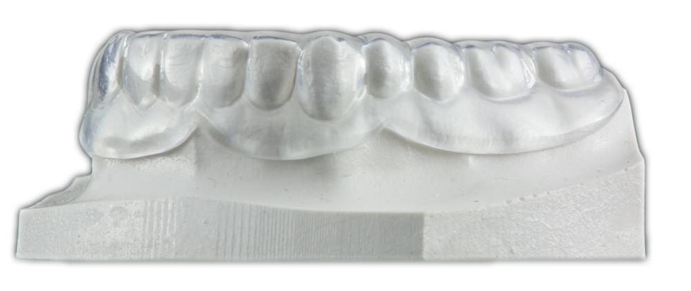 Soft Occlusal Splint