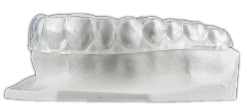 Dual Laminate Occlusal Splint